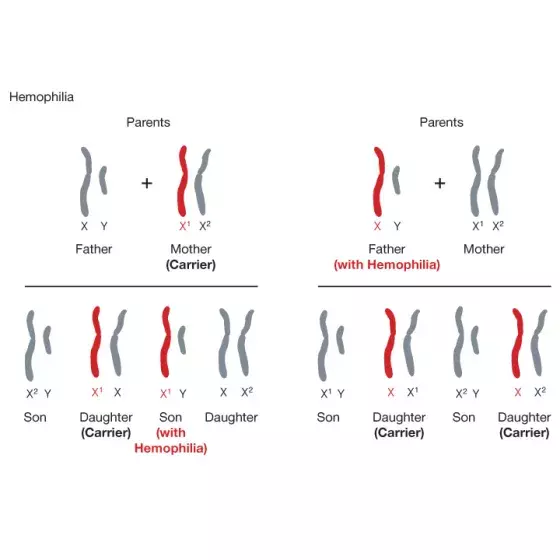 Hemophilia illustration